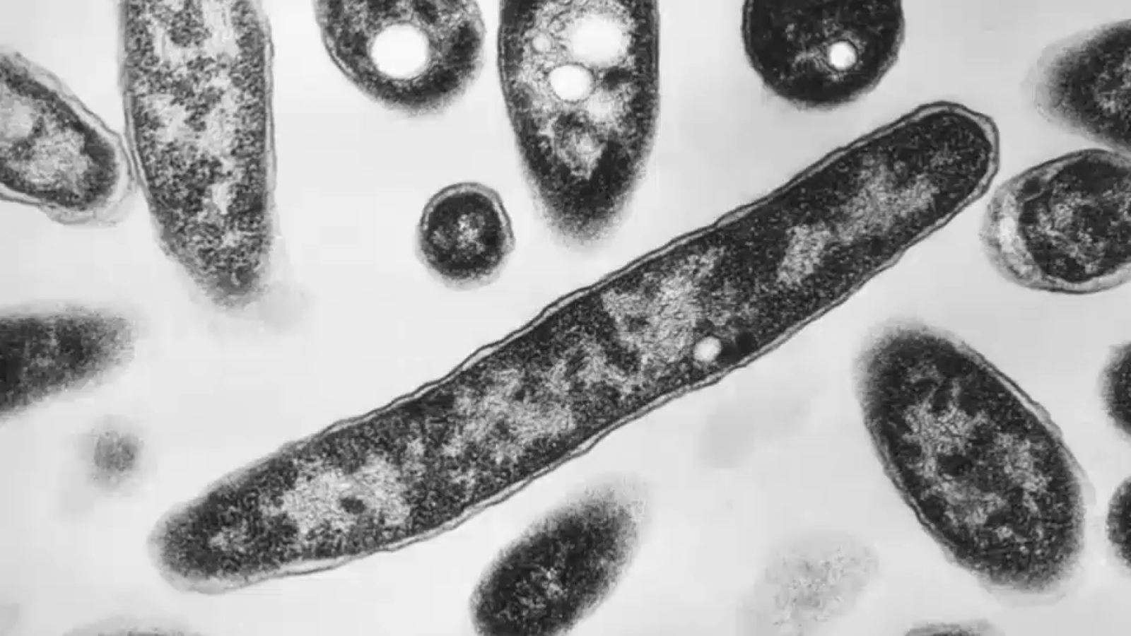 Efforts to Contain the Outbreak