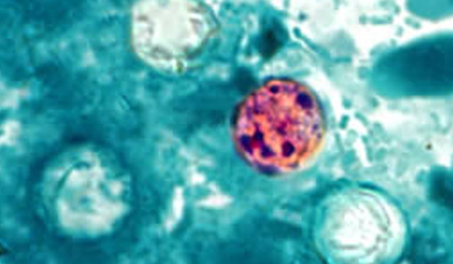 A microscopic image of Cyclospora cayetanensis, the parasite that causes cyclosporiasis