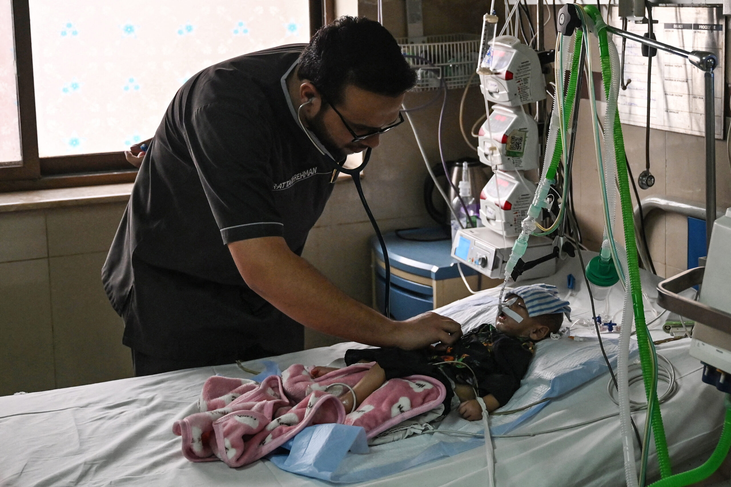 Severe Pneumonia