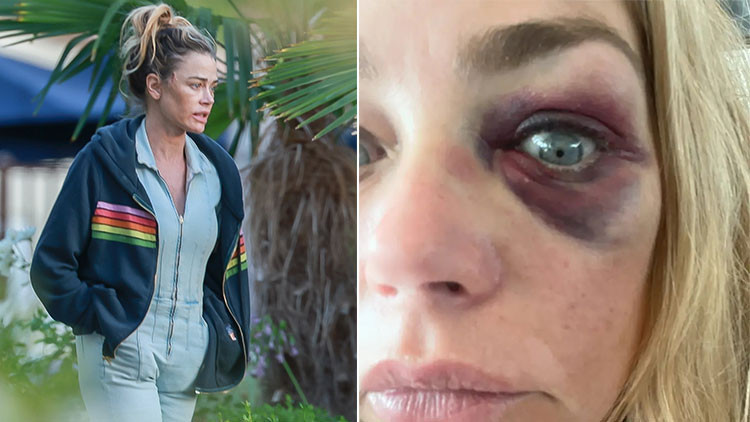Denise Richards and Esra Yalınkaya Detail Domestic Violence and Legal Battles