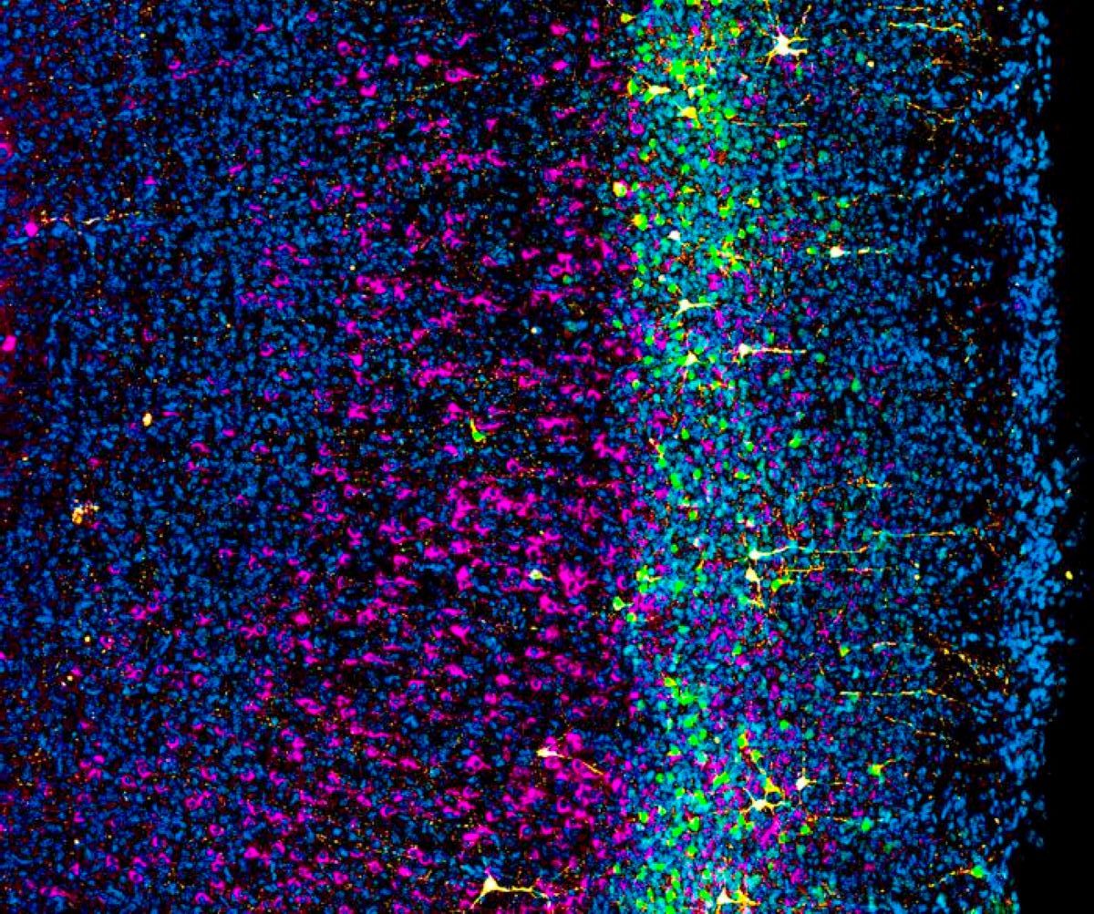Neural Stem Cells Split Early Into Distinct Neuron Lineages