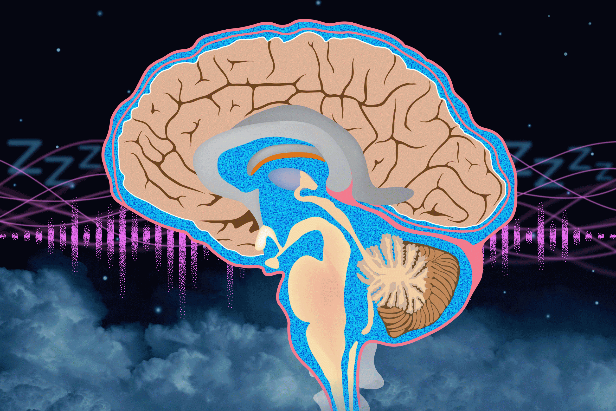 Pink Noise Boosts Brain Waste Clearance During Sleep